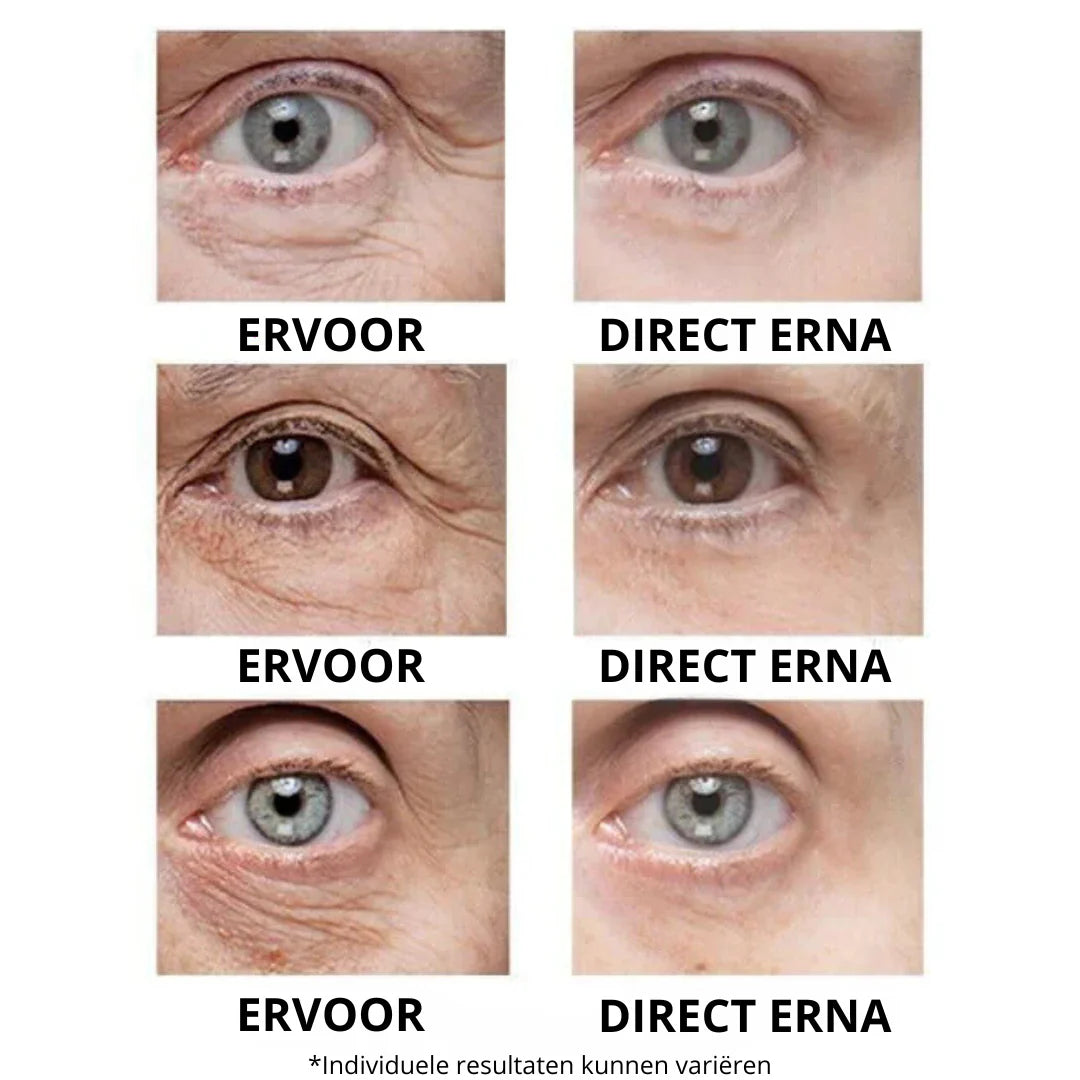 Instant Oogkringen- en Rimpelcrème™