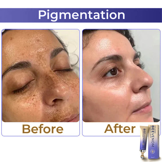 ✨ flysmus™ Collagen+ Bee Venom Roller Eye Cream 🇦🇺 Dermatologist Approved